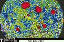 Se muestran en rojo-naranja los mascoms en <a href=http://science.nasa.gov/headlines/y2006/images/loworbit/fig8.jpg target=_blank>la Luna</a>, que hacen tan irregular a su campo gravitacional, tal como fueron detectados por la misin Lunar Prospector. Los cinco ms grandes corresponden a los mayores crteres llenos de lava o mares lunares, visibles con binoculares sobre la cara iluminada de la Luna: el Mar de la Lluvia (Mare Imbrium), el Mar de la Tranquilidad (Mare Serenitatus), el Mar de la Crisis (Mare Crisium), el Mar de la Humedad (Mare Humorum) y el Mar del Nctar (Mare Nectaris). Referencia: Konopliv et al, Icarus <strong>150</strong>, 18 de enero de 2001.