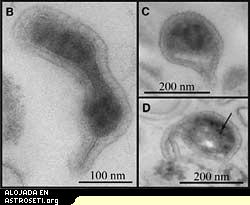 Tres enigmáticas arqueobacterias de los deshechos rosados de la Mina de Richmond en California. Las imágenes de este tipo, de micrografía de transmisión de electrones (TEM), muestran que la mayoría tienen protrusiones (B), áreas oscuras que probablemente serán ribosomas empaquetados (C) e inclusiones oscuras no identificadas (D). La escala de los 100 nanómetros es aproximadamente una milésima del ancho de un cabello humano.
Créditos: Brett Barker/UC Berkeley