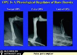 <i>La OPG podra ser una eficaz contramedida a la prdida sea experimentada por los astronautas y por pacientes con osteoporosis.</i> 