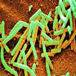 Los mayores supervivientes en el desprotegido vacío y frío espaciales: 6 años Bacillus subtilis (en un satélite de la NASA. Crédito: NASA