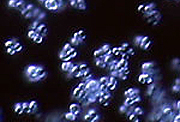 Si la vida existe fuera de la Tierra, ¿está limitada a vida microbiana unicelular como las bacterias?
Crédito: BioMEDIA