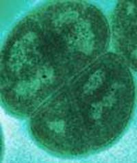 Microfotografa de electrones de D. radiodurans. Deinococcus radiodurans es el organismo ms resistente a la radiacin conocido, lo que lo hara lo ms parecido a la vida en Europa. Crdito: DOE