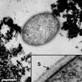 Sección fina de la Cepa 121, la denominada “bacteria inhervible” que sobrevive el calentamiento en alta presión en un autoclave a 121 grados Celsius, o 250 grados Fahrenheit.