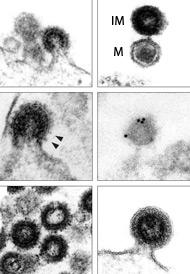 retrovirus