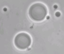 Polímerosomas gigantes (2-20 mm) en una solución salina tamponada con fosfato
- vistos al microscopio de contraste de fases (solución interna de sacarosa 300 mM). Crédito: Universidad de Pennsylvania.