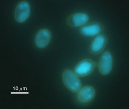 Giardia lamblia. Este organismo unicelular enferma a las personas si es encontrado en el agua que beben. Crdito de la foto: H. Lindquist, US EPA. [<A HREF= http://www.cfsan.fda.gov/%7Emow/chap22.html target=_blank>Ms</A>] 