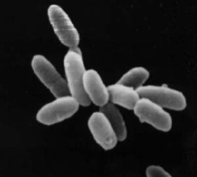 Clulas de Halobacterium vistas a travs de un microscopio de alta resolucin. Las clulas individuales en la imagen tienen unas 5 micras de largo. [<a href=http://soils1.cses.vt.edu/ch/biol_4684/Microbes/halo.html target=_blank><u>Ms</u></a>] 