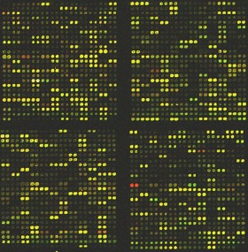 Un microcircuito de ADN, visto a través de un microscopio. Cada pequeño punto corresponde a uno de los miles de genes del organismo y el color del punto indica el nivel de actividad de ese gen.
<i>Crédito de la Imagen: <a href=http://www.ualberta.ca/%7Emmi/faculty/jsmiley/jsmiley.html target=_blank>James Smiley.</a></i>