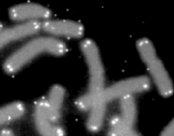 <a href= http://science.nasa.gov/headlines/y2006/images/telomeres/caps.gif target=_blank>Los Telmeros</a> (blanco) tapan los extremos de los cromosomas humanos (gris). Crdito imagen: Programa del Genoma Humano del Departamento de Energa de U.S.A. 
[<a href=http://gslc.genetics.utah.edu/features/telomeres/>Ms informacin</a>] 
