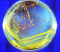 <i>D. radiodurans</i> creciendo en un medio de cultivo de agar. El color rojo se debe a un pigmento de carotenos. Enlace a <a href=http://science.nasa.gov/newhome/headlines/images/conan/D_rad_dish.jpg target=_blank><u>816x711-pixel, 351KB JPG</u></a>. Crdito: M. Daly, Uniformed Services University de Ciencias de la Salud.  