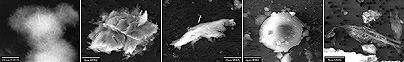 <i>Mickey Mouse, Klingon, marsopa, esfera ,y sobras de pavo son motes dados a objetos encontrados en hielo Antártico a una profundidad de 1.249 metros bajo la estación Vostok. <a href= http://science.msfc.nasa.gov/newhome/headlines/ast12mar98_1.htm target=_blank><u>Relato completo.</u></a></i>